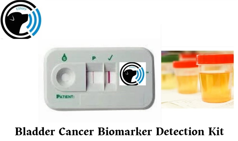 Esniff Devices Democratizing Bladder Cancer Detection Through Innovative Biomarker Kit