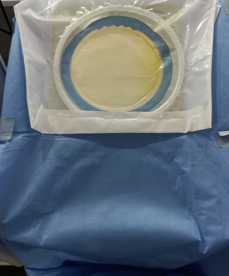Antimicrobial Breakthrough - Fabiosys Innovations Eliminates Infections by Reinventing Anti-infective Surgical Supplies