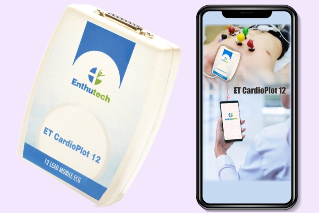 Revolutionizing Cardiac Care - Enthutech’s 100g Portable, Smart ECG Device Runs on Mobile Power, Not Batteries