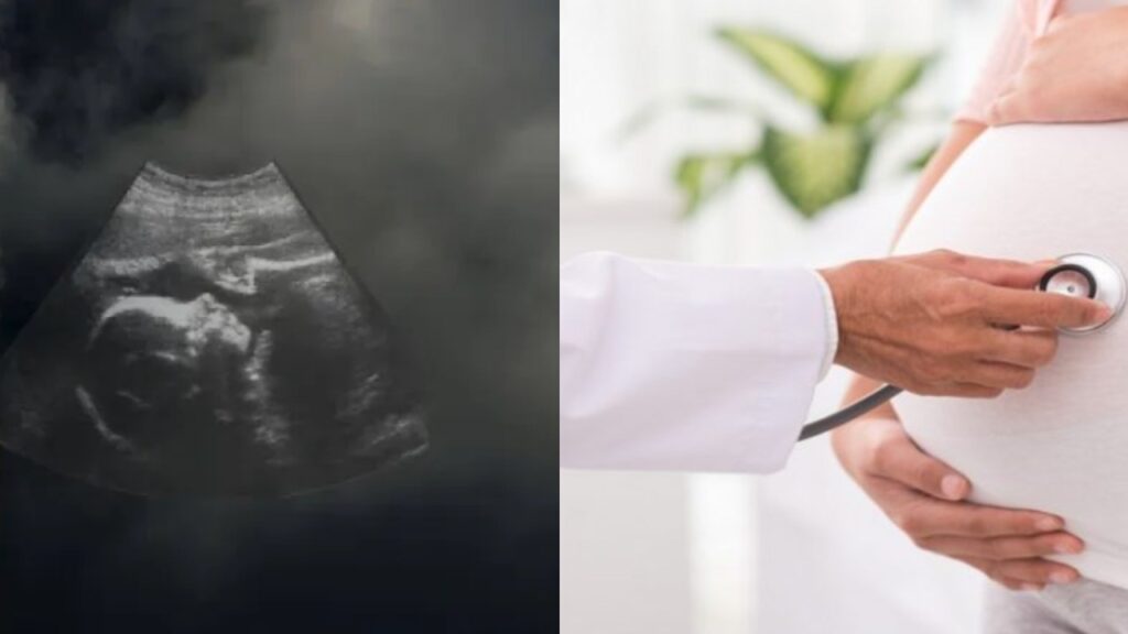 Air Pollution Endangers Pregnancy and Newborns