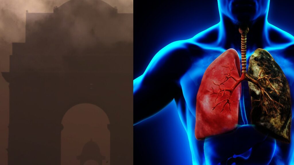 Air Pollution and Its Alarming Impact on Public Health