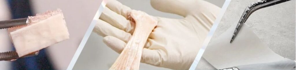 Haomagraft Reimagining Ethical and Safe Bone Banking in India